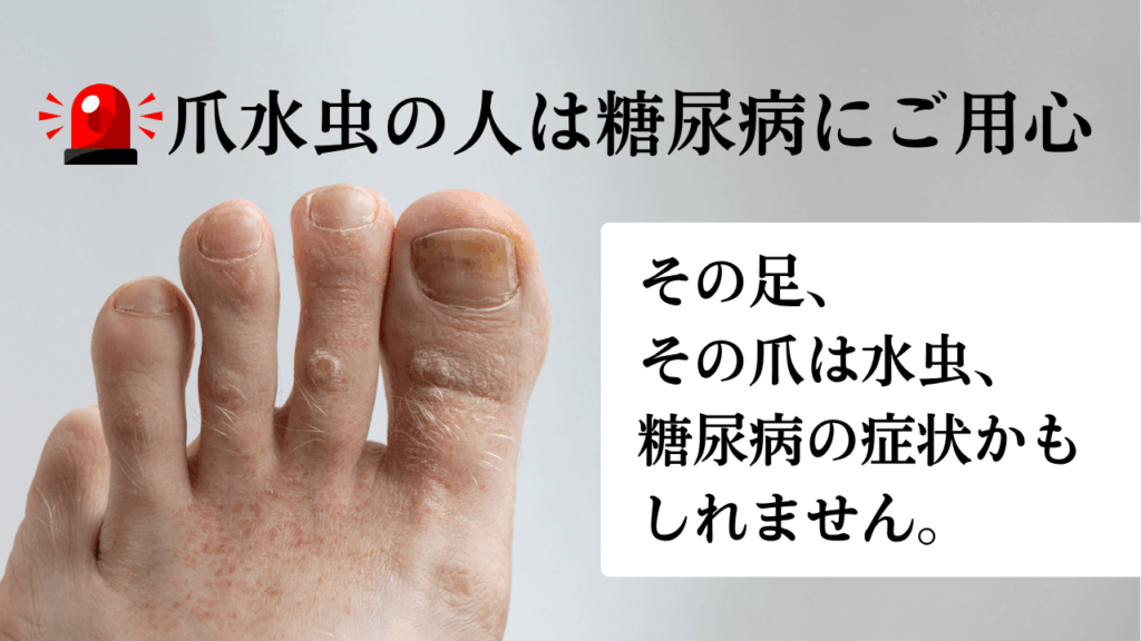 爪水虫の人は糖尿病にご用心